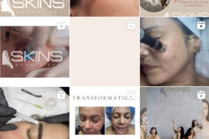 Skins Beauty Spa: tratamiento de estética facial personalizado